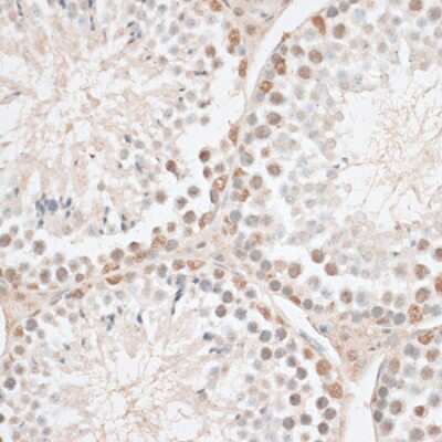 Immunohistochemistry-Paraffin: HMGN1/HMG14 Antibody - BSA Free [NBP3-03219]